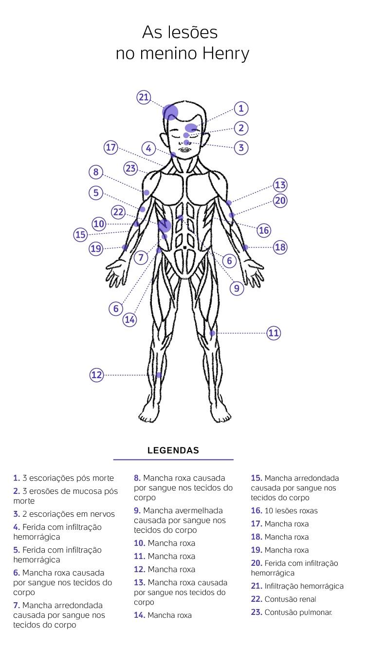 Babá afirma que Jairinho questionou Henry após agressões sobre o ele teria tido à mãe 