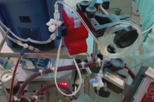 Covid-19: Sobe procura por pulmão artificial usado por Paulo Gustavo