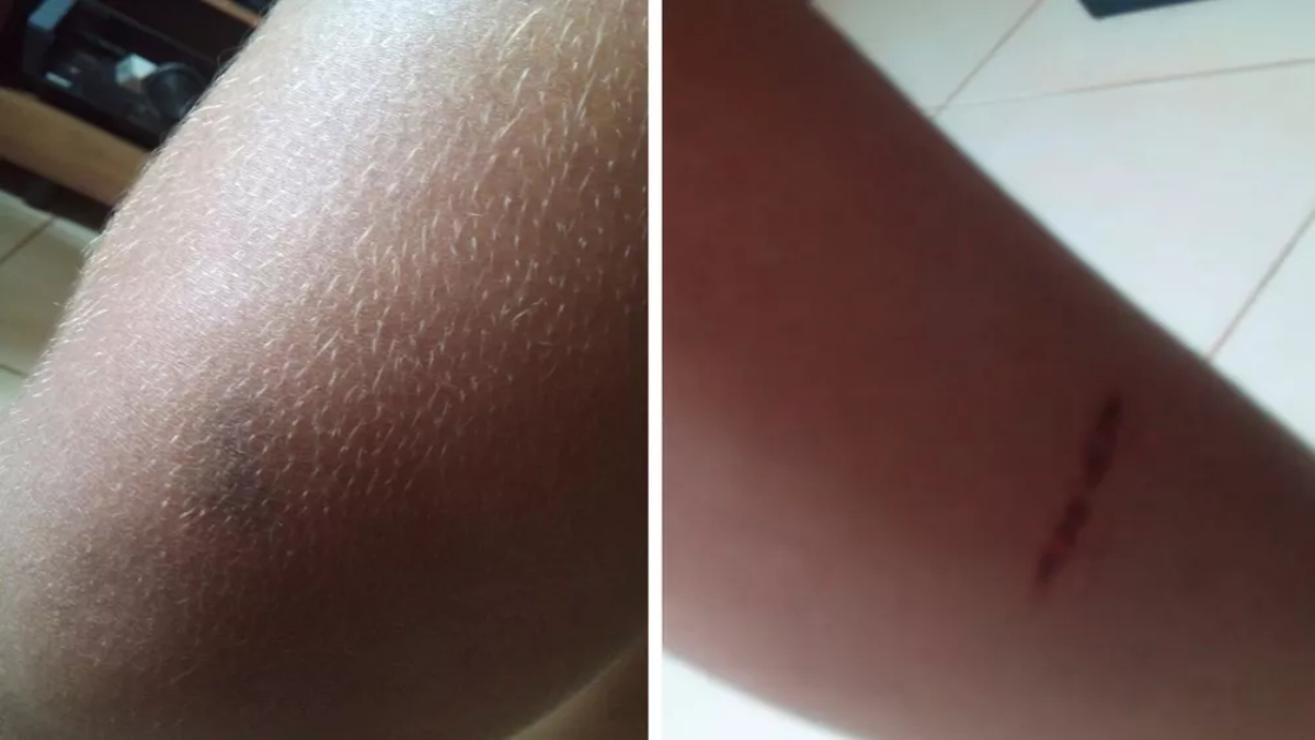 Adolescente desaparecida é encontrada com ferimentos e hematomas pela família