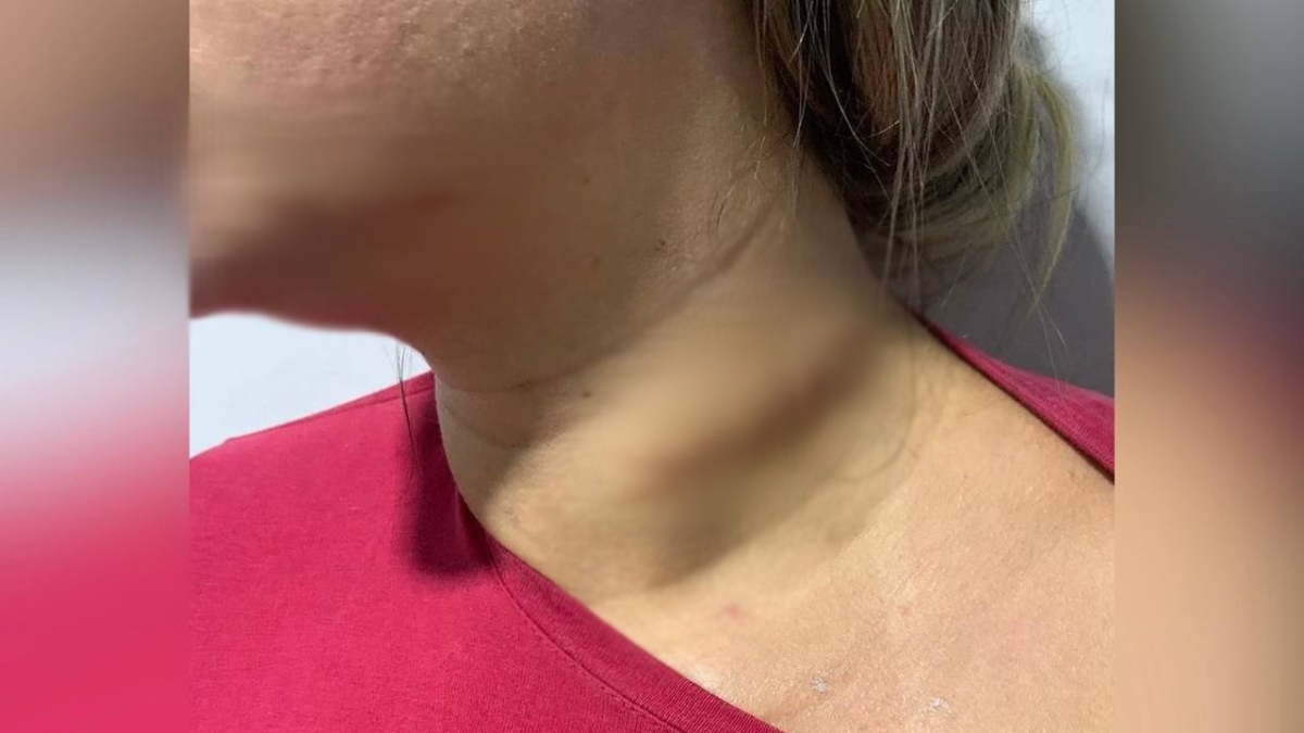 Preso suspeito de esfaquear pescoço da ex-companheira, em Piracanjuba