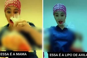 A cirurgiã plástica Caren Trisoglio Garcia foi suspensa após compartilhar no Tik Tok vídeos que mostram pedaços de pele e sacos Cirurgiã é suspensa após postar vídeos com pele de pacientes (Foto: Reprodução/Tik Tok)