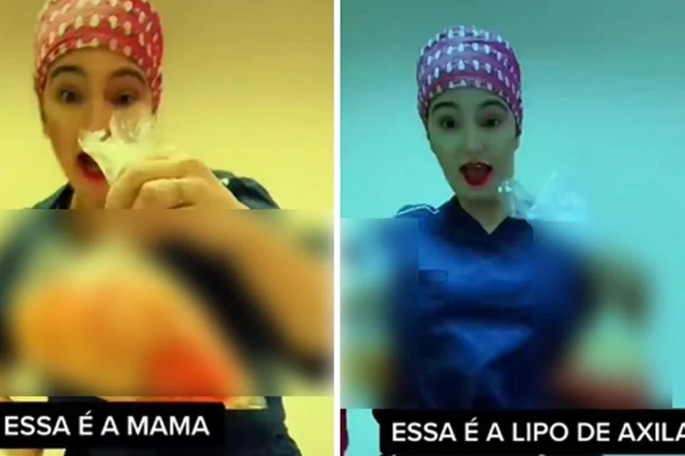 A cirurgiã plástica Caren Trisoglio Garcia foi suspensa após compartilhar no Tik Tok vídeos que mostram pedaços de pele e sacos Cirurgiã é suspensa após postar vídeos com pele de pacientes (Foto: Reprodução/Tik Tok)