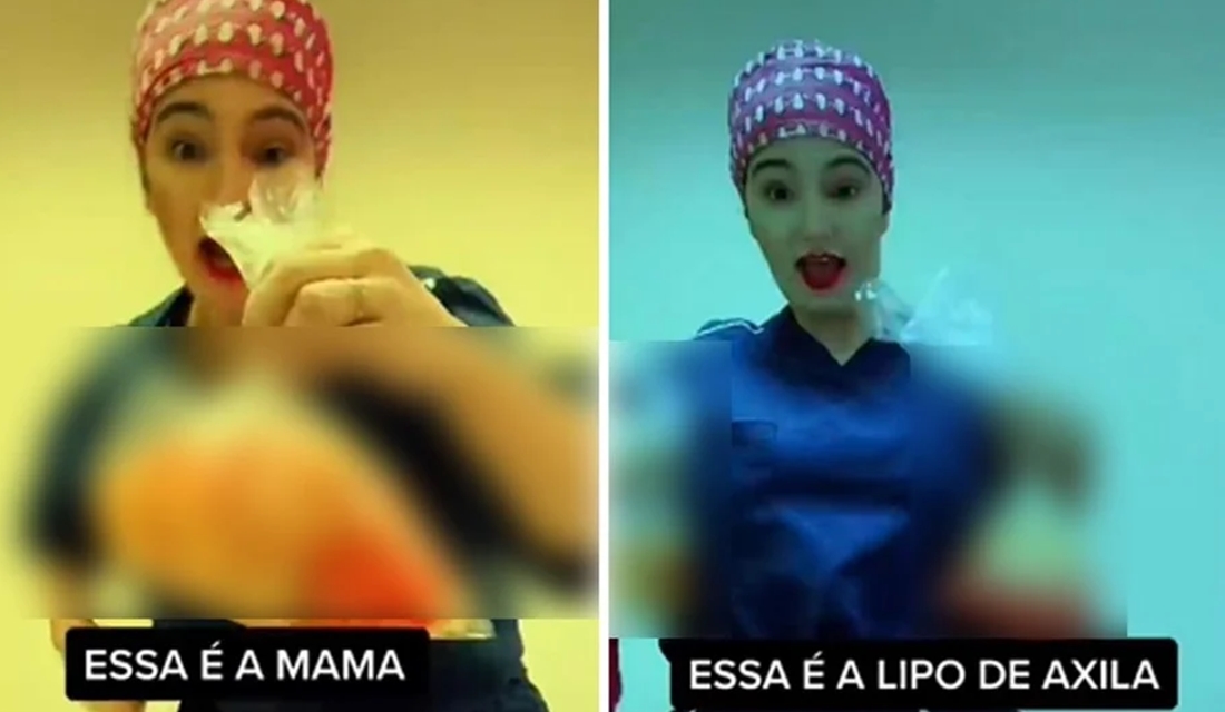 A cirurgiã plástica Caren Trisoglio Garcia foi suspensa após compartilhar no Tik Tok vídeos que mostram pedaços de pele e sacos Cirurgiã é suspensa após postar vídeos com pele de pacientes (Foto: Reprodução/Tik Tok)