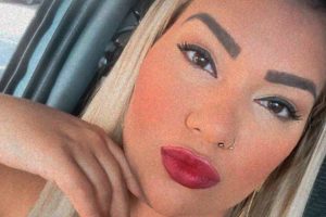 Mulher Filé fará cirurgia às pressas por complicações nas próteses de silicone