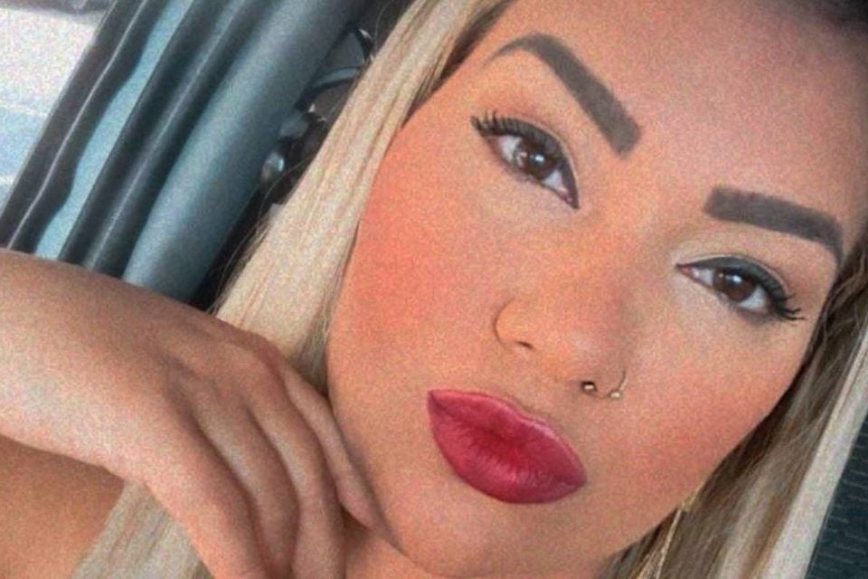 Mulher Filé fará cirurgia às pressas por complicações nas próteses de silicone