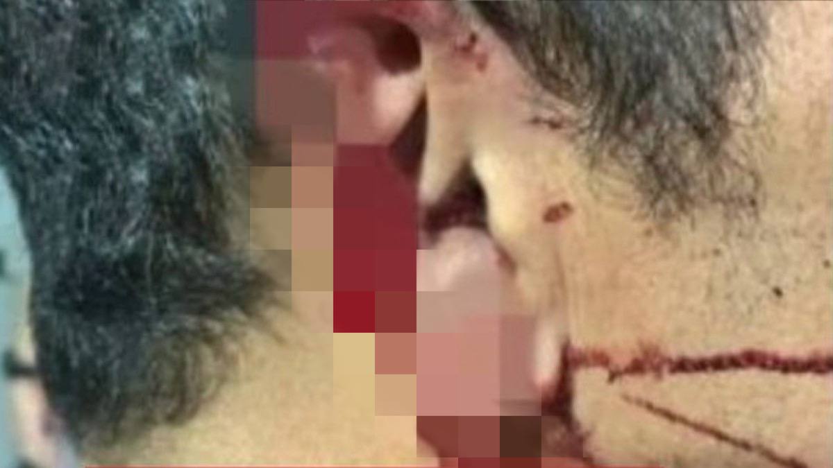 Após um desentendimento em bar, um homem teve parte da orelha arrancada com uma mordida durante uma luta corporal, em Mineiros