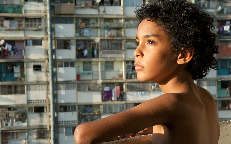 Pelo Malo