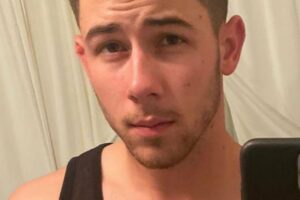 Nick Jonas se fere em set de filmagem e é hospitalizado