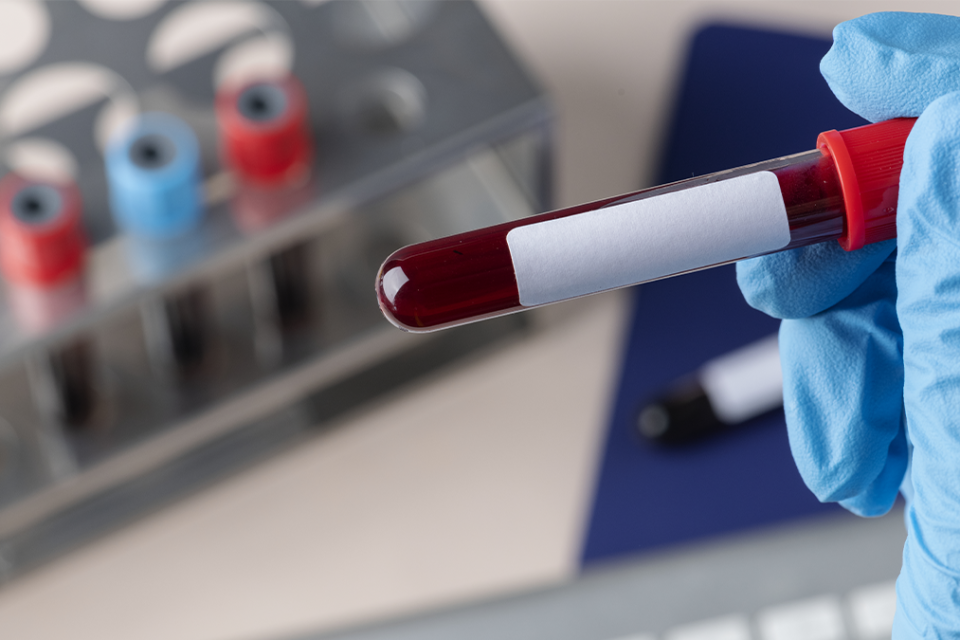 Vírus ainda infecta 1,5 milhão de pessoas por ano e mata cerca de 650 mil Falhou a única vacina em testes avançados contra o HIV