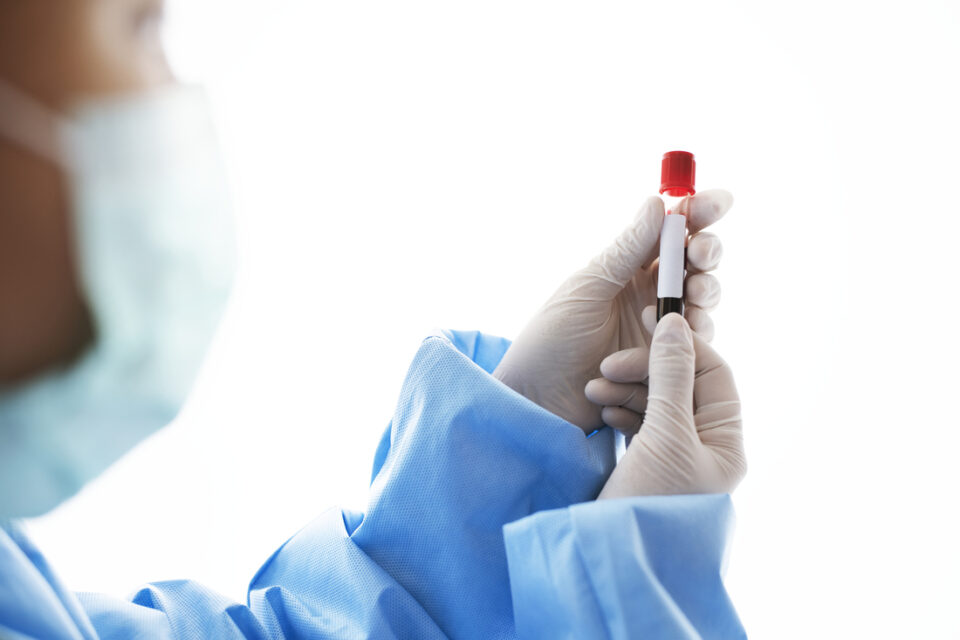 Doctor holding a blood test tube
