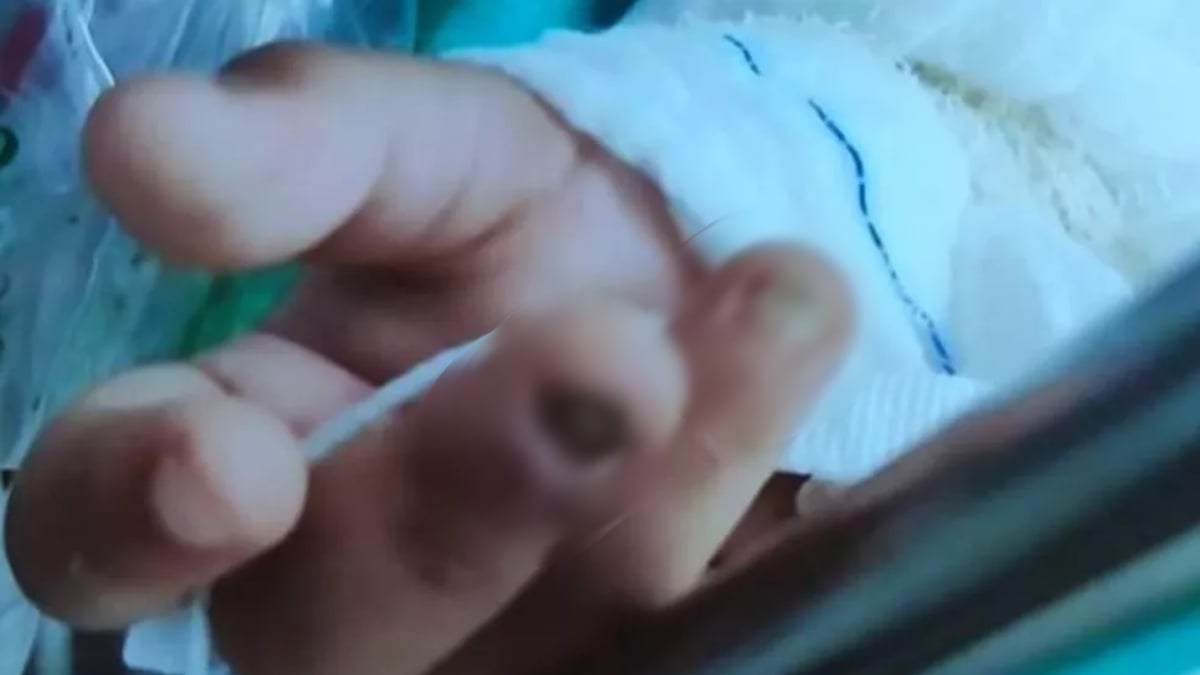 Menina de 2 anos foi levada a um hospital de Goiânia sem duas unhas e com ferimentos pelo corpo, inclusive, no intestino