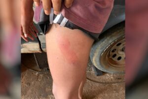 Um morador de Jataí é suspeito de espancar o filho por ser homosexual. A Polícia Civil teve conhecimento do caso nesta quarta-feira (5), Em Jataí, homem é suspeito de espancar filho por ser homossexual