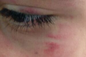 Preso suspeito de bater e ameaçar perfurar pulmão de enteado em Mineiros