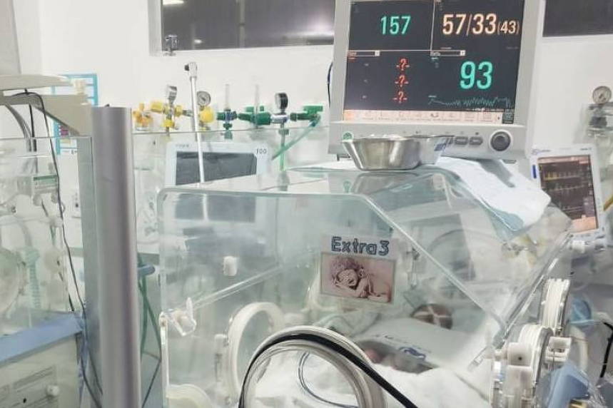 Brasil tem 'legião de bebês prematuros' com alta de covid em grávidas (Foto: Divulgação)