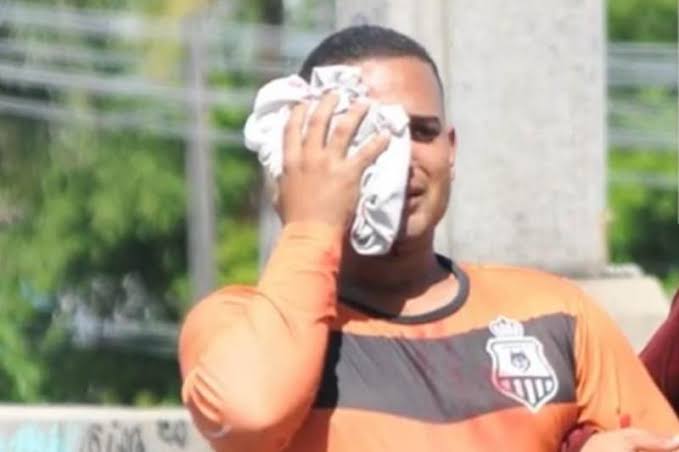 Arrumador Jonas França, que ficou cego de um olho (Foto: redes sociais)