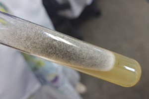 Cultura do fungo zigomiceto, da ordem dos Mucorales, um dos que causam a mucormicose, em foto do médico residente em infectologia José Bampi, no Hospital das Clínicas, em SP Foto: José Bampi/Reprodução