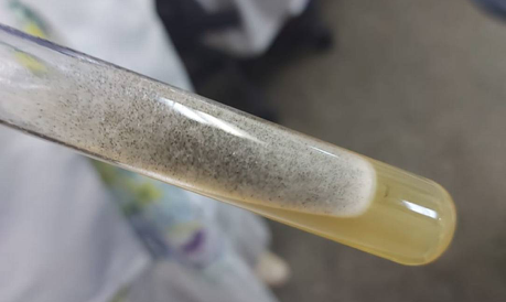 Cultura do fungo zigomiceto, da ordem dos Mucorales, um dos que causam a mucormicose, em foto do médico residente em infectologia José Bampi, no Hospital das Clínicas, em SP Foto: José Bampi/Reprodução