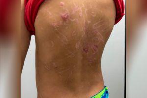 Suspeito de torturar filho submetia criança a afogamento e eletrochoque (Foto: Divulgação/PC)