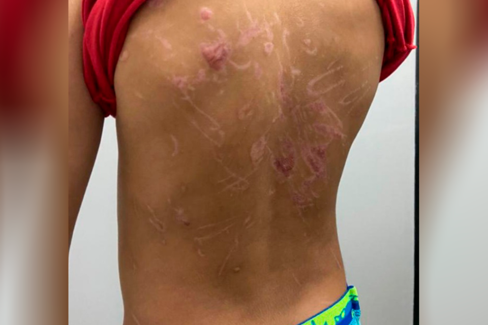 Suspeito de torturar filho submetia criança a afogamento e eletrochoque (Foto: Divulgação/PC)
