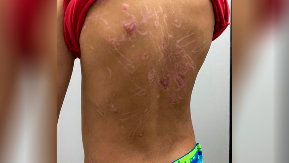 Suspeito de torturar filho submetia criança a afogamento e eletrochoque (Foto: Divulgação/PC)