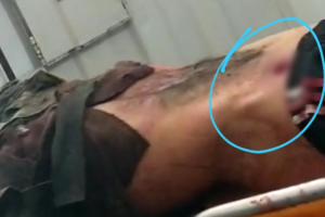 Homem chegou a ser encaminhado a um hospital, mas não resistiu e morreu na unidade