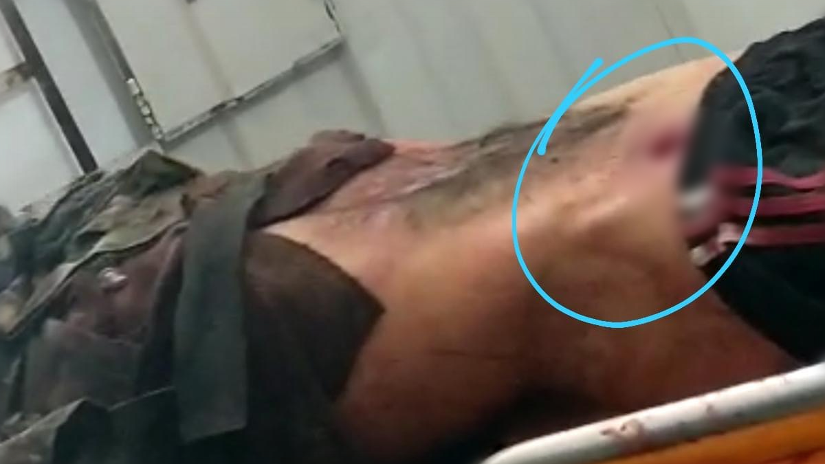 Homem chegou a ser encaminhado a um hospital, mas não resistiu e morreu na unidade