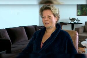 Além disso, a deputada apresentou uma lesão na coluna e diversos traumas pelo corpo, mas não lembra o que aconteceu