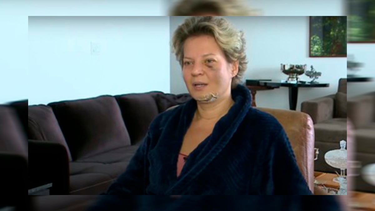 Além disso, a deputada apresentou uma lesão na coluna e diversos traumas pelo corpo, mas não lembra o que aconteceu