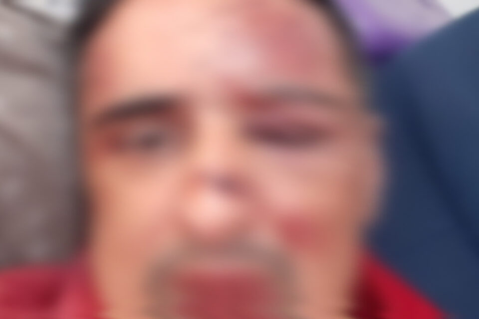 Versão do adv