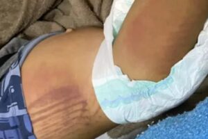 Mãe e padrasto são suspeitos de torturarem duas crianças em Cristalina