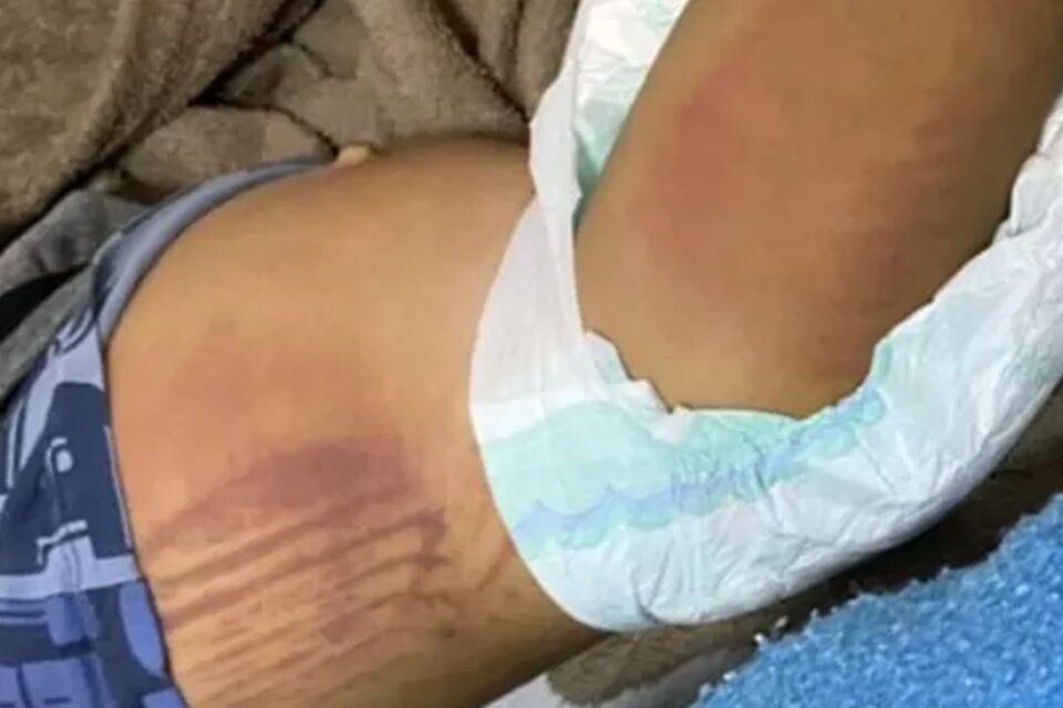 Mãe e padrasto são suspeitos de torturarem duas crianças em Cristalina