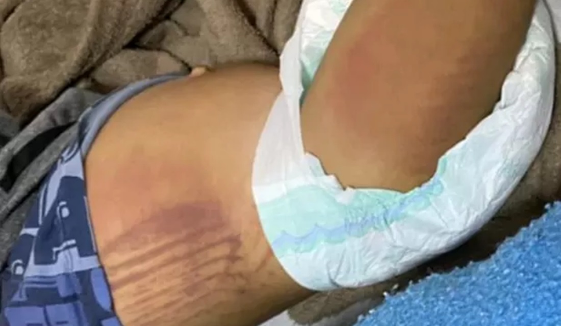 Mãe e padrasto são suspeitos de torturarem duas crianças em Cristalina