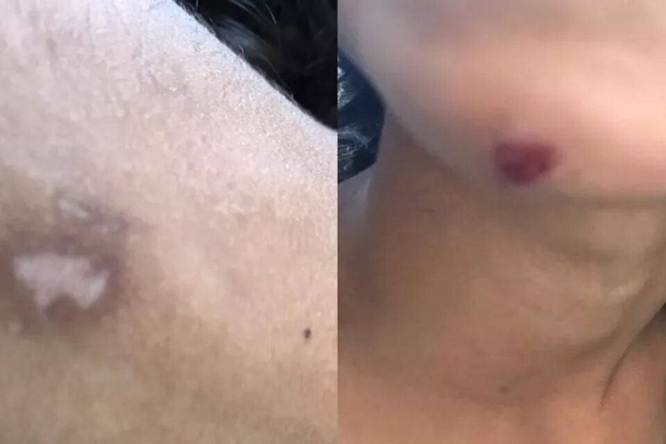 Em Goiânia, crianças agredidas pelo pai fogem de casa para pedir ajuda; suspeito foi preso