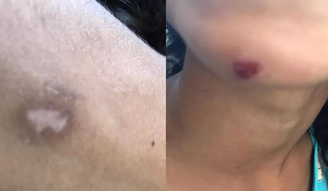 Em Goiânia, crianças agredidas pelo pai fogem de casa para pedir ajuda; suspeito foi preso