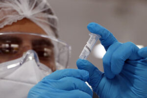 Goiás confirma quatro casos da variante Delta e um em investigação