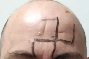 Homem gay é agredido e tem suástica desenhada na testa em ataque em MG