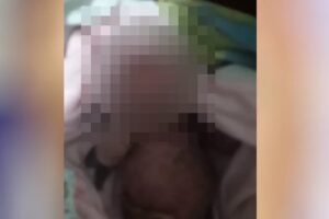 Recém-nascida é encontrada abandonada debaixo de árvore, em Goiânia