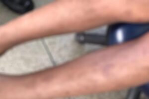 Em Goiânia, crianças agredidas pelo pai fogem de casa para pedir ajuda; suspeito foi preso (Foto: Divulgação/PM)