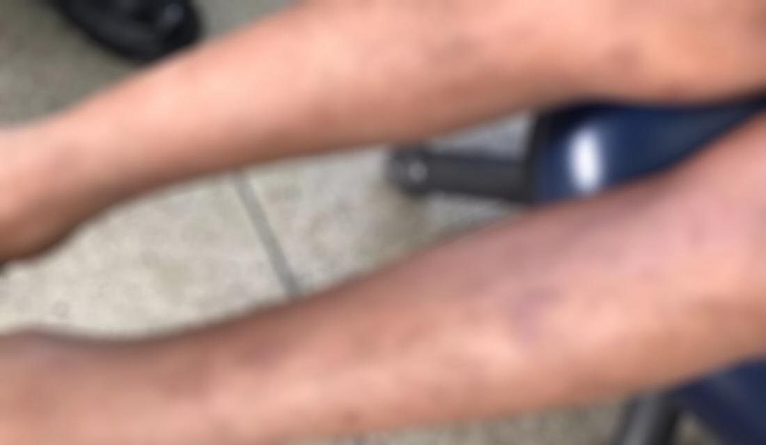 Em Goiânia, crianças agredidas pelo pai fogem de casa para pedir ajuda; suspeito foi preso (Foto: Divulgação/PM)