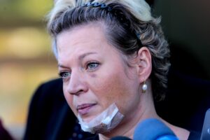 Deputada, que desconfia de atentado, disse ter tomado medicamento para dormir antes de acordar com hematomas