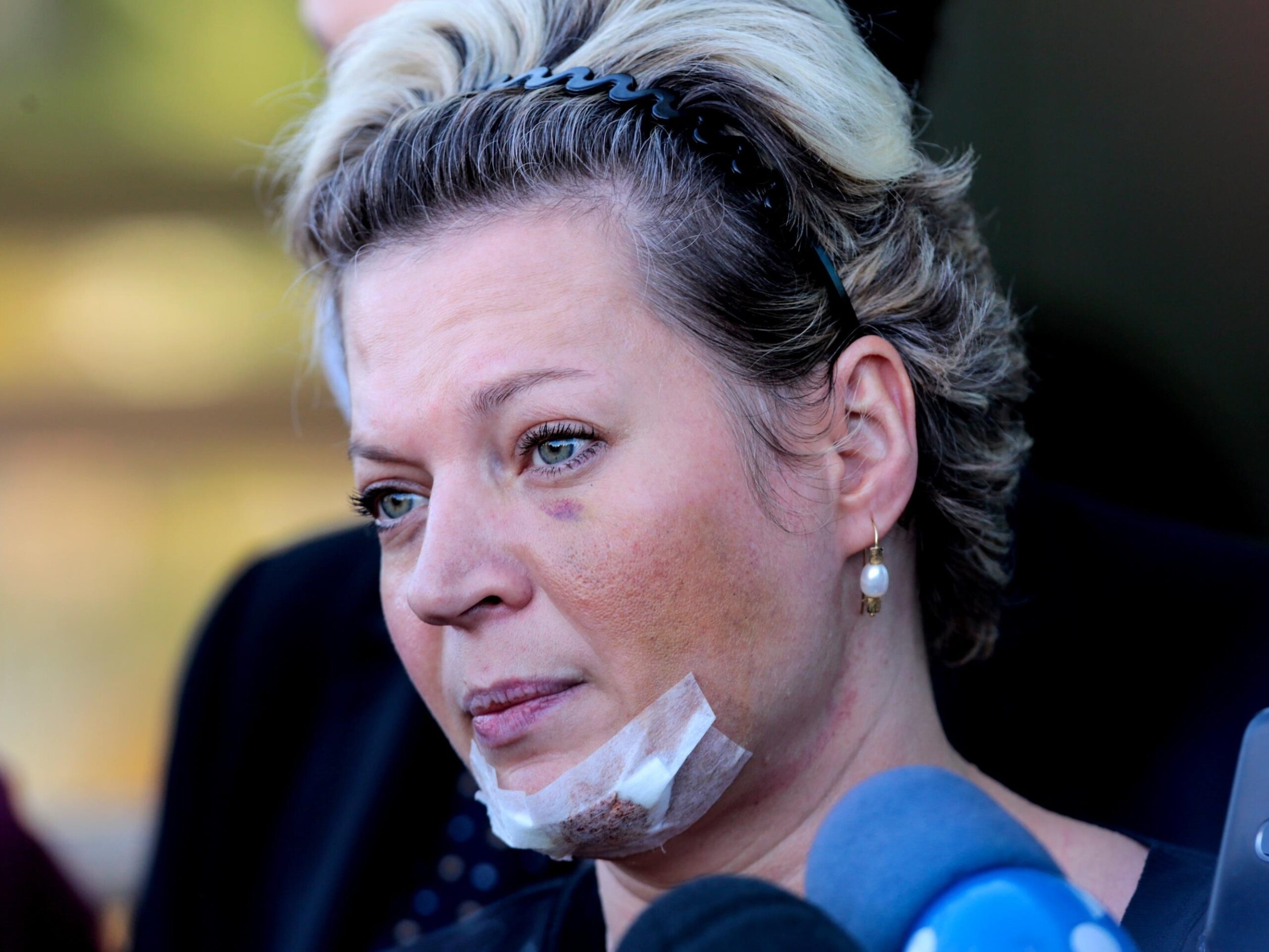 Deputada, que desconfia de atentado, disse ter tomado medicamento para dormir antes de acordar com hematomas