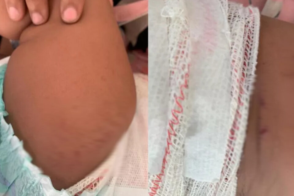Homem se revolta com cobrança de máscara, lança fogo de artifício e atinge bebê