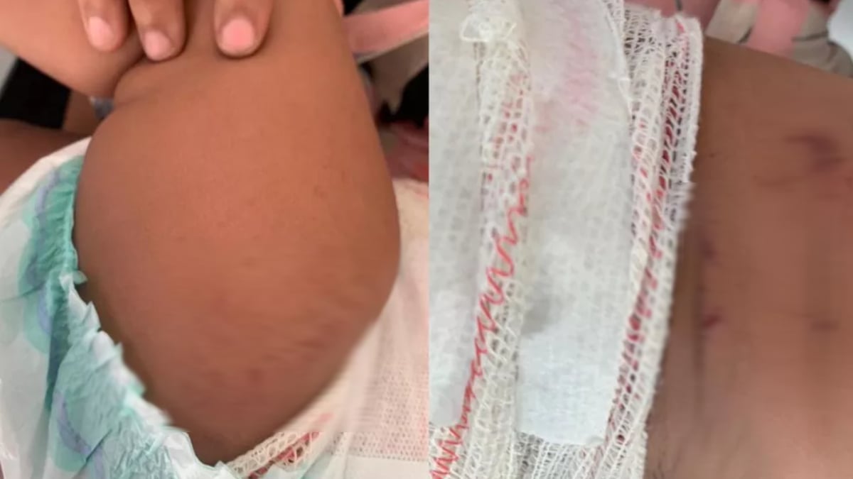 Homem se revolta com cobrança de máscara, lança fogo de artifício e atinge bebê (Foto: Divulgação/PC)