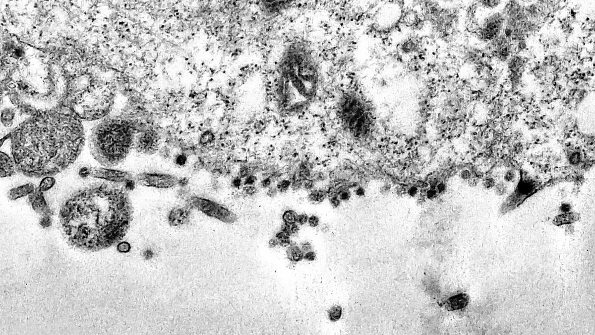 Pesquisadores da Unicamp criam modelo para prever mutações da covid-19