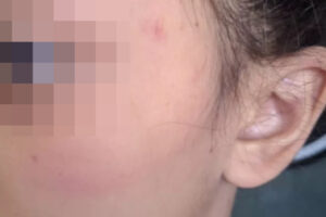 Mãe agride filha de 9 anos após menina esquecer maionese fora da geladeira, em Jaraguá