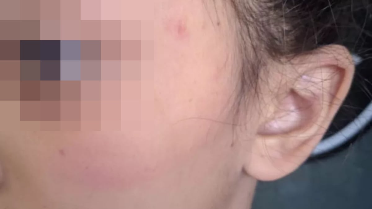 Mãe agride filha de 9 anos após menina esquecer maionese fora da geladeira, em Jaraguá