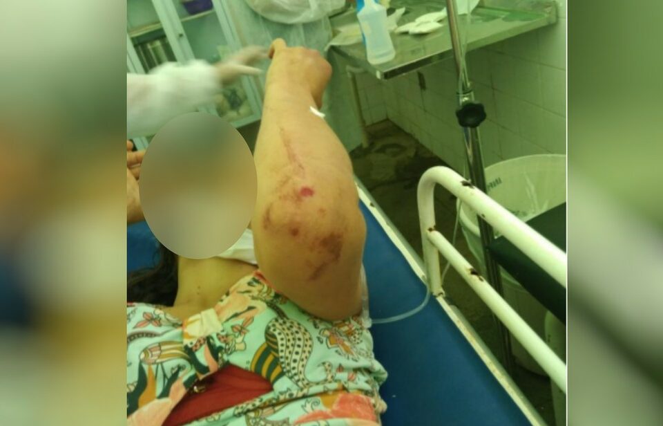 Mulher espancada durante quatro horas pelo marido aparece em maca de hospital