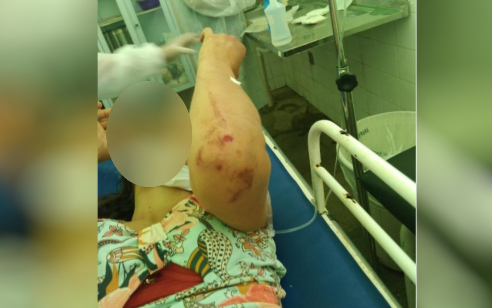 Mulher espancada durante quatro horas pelo marido aparece em maca de hospital