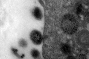 Pesquisa identificou interrupção na tendência de queda dos casos