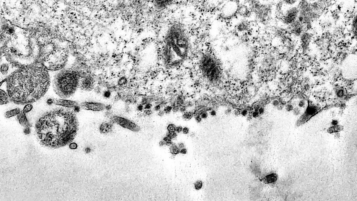 OMS destaca a produção de antivirais genéricos contra a covid-19